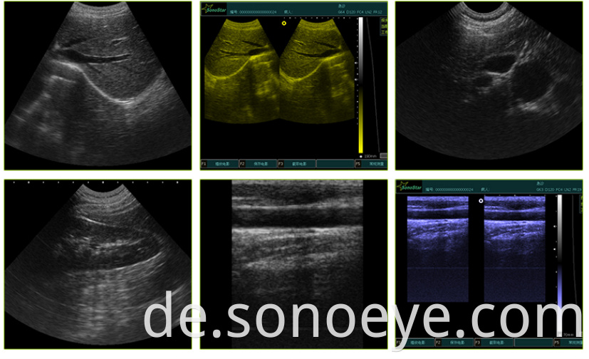 Portable Ultrasounder For Vet